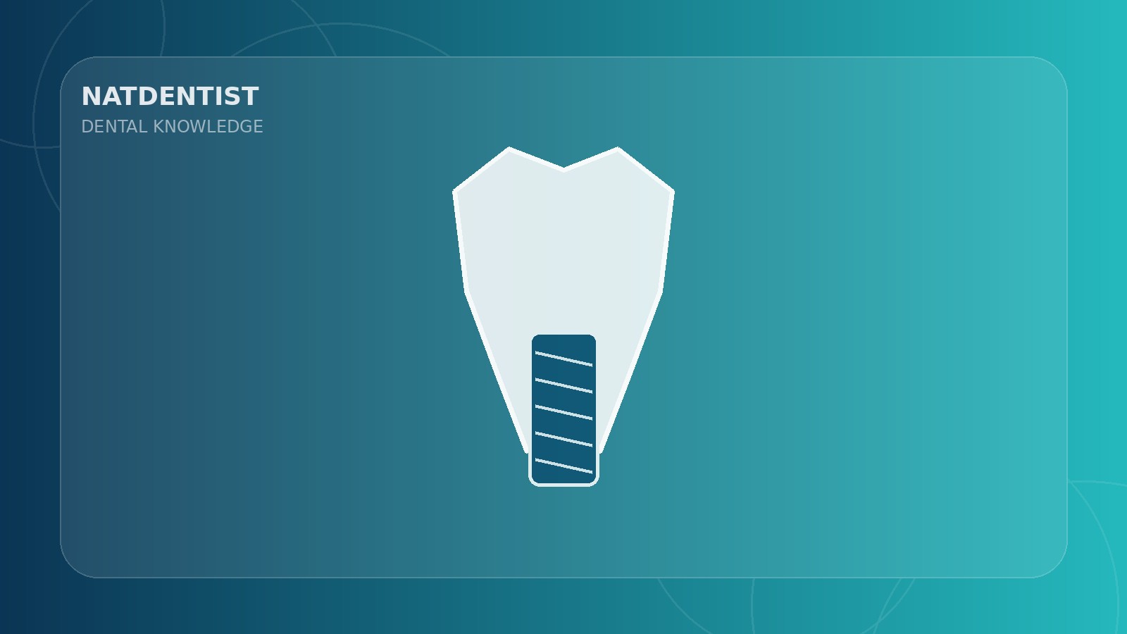 Dental Implants: A Complete Guide